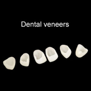 dental veneers smile trans 6